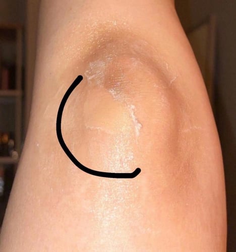 مقشر احماض فواكه 60%