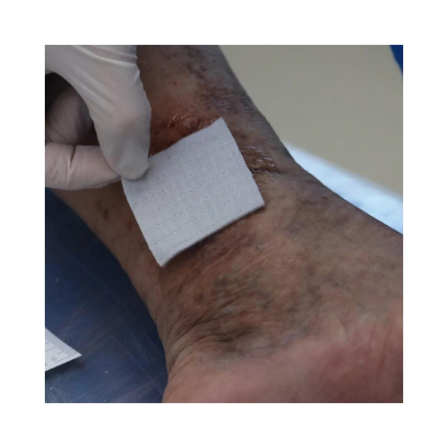 ضماد اكواسيل بالفضة 5سم×5سم