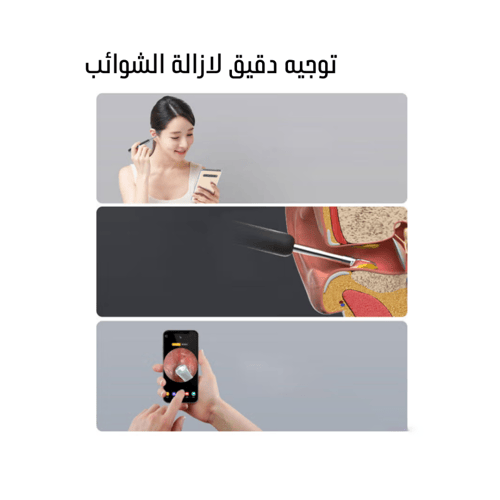 جهاز تنظيف الاذن