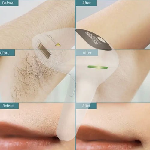 Package of 2 devices from the developer