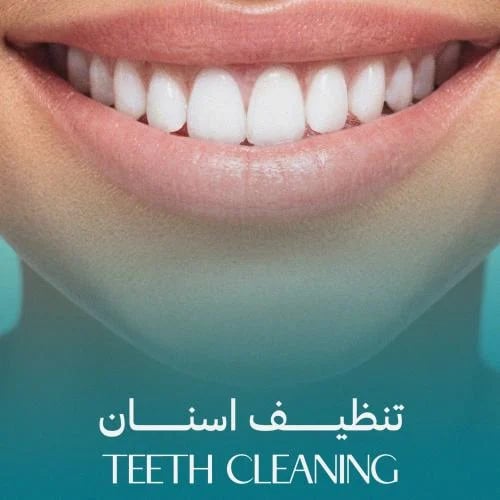 تنظيف وتلميع اسنان