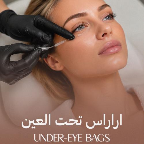 اراراس تحت العين