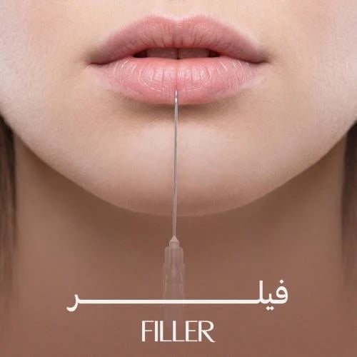 1مل فيلر للشفايف