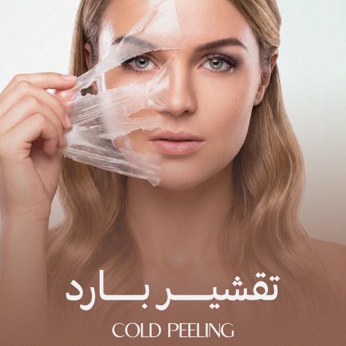 تقشير بارد(اميلان)