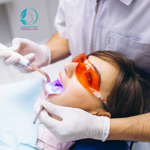 جلسة تنظيف وتبييض ضوئي للأسنان