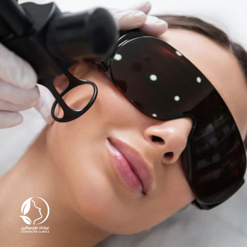 تشقير شنب - Blonding mustache