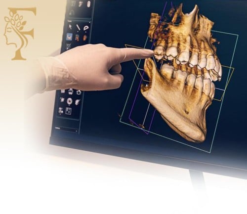 اشعة البانوراما