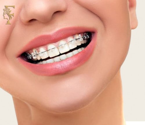 قاعدة تركيب للفك الواحد