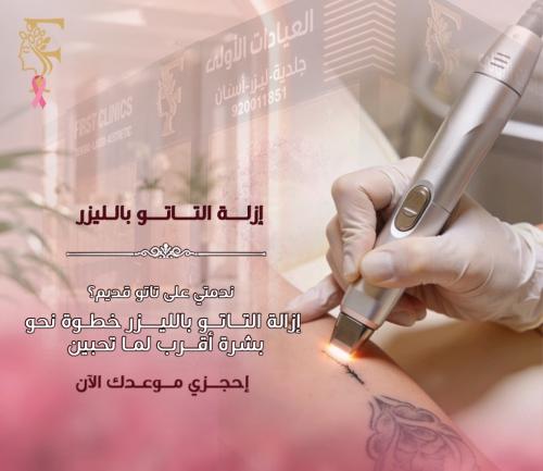 جلسة ازالة تاتو حواجب