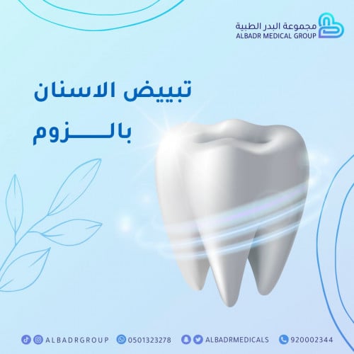 تبييض الاسنان بتقنية الزوم مع تركيب كرستالة