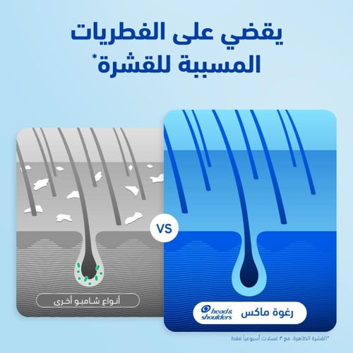 هيد آند شولدرز، شامبو ضدّ القشرة، انتعاش الليمون،...