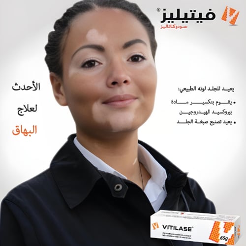فيتيليز كريم توحيد لون البشرة وعلاج البهاق - 65 جر...