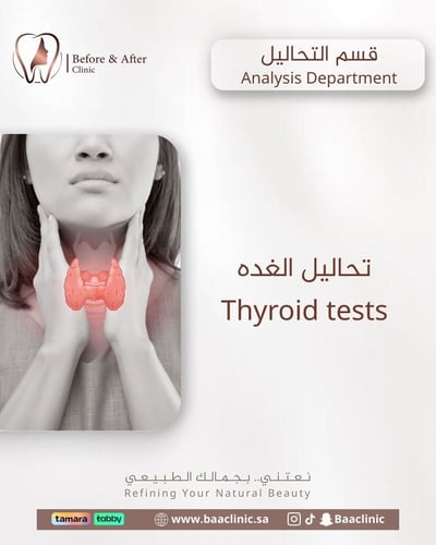 تحاليل الغده