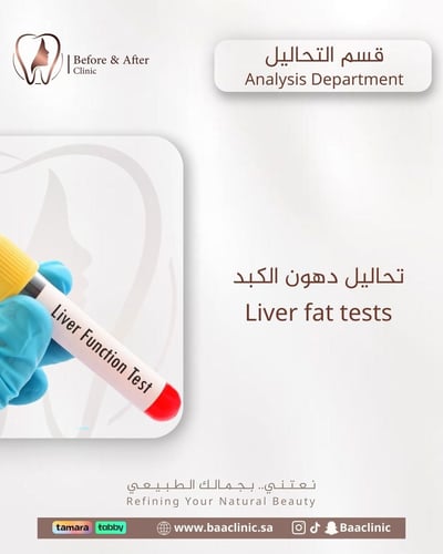 تحاليل دهون الكبد