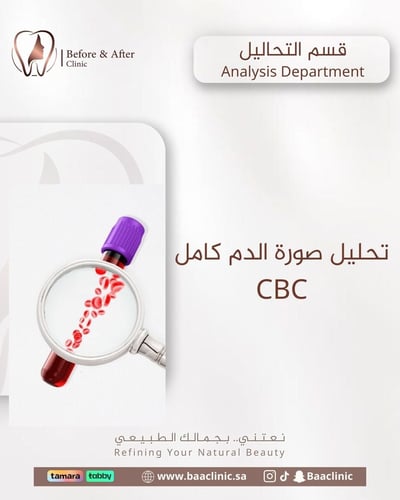 تحليل صورة الدم كامل