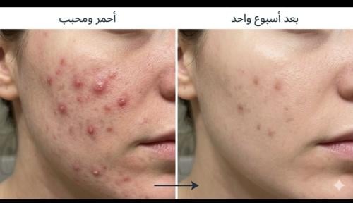 عرض مجموعه اليوم الوطني. 370
