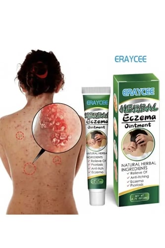 مرهم اكزيما عشبي، مرهم طبي لالتهاب الجلد، والحكة،...