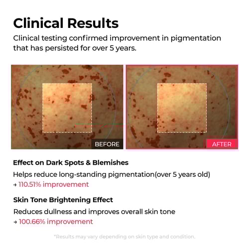 سيروم جل لتفتيح البشرة من دكتور ميلاكسين - 30 مل