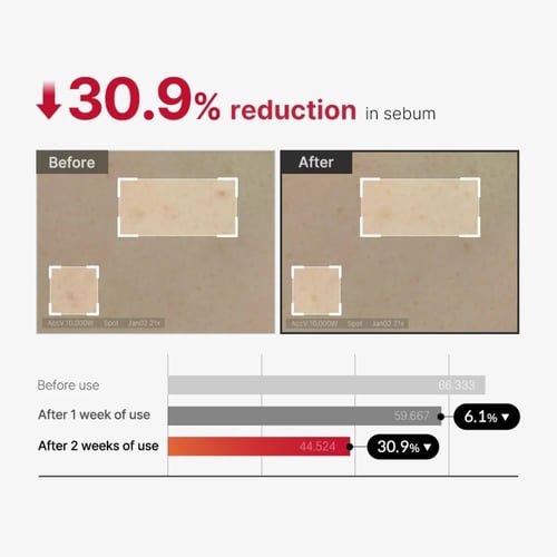 بخاخ تقشير الجسم لعلاج حب الشباب من ميديكيوب - 110...