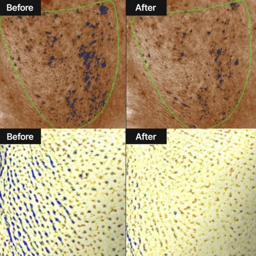 كريم تفتيح البشرة والبقع الداكنة وتقليل المسام من...