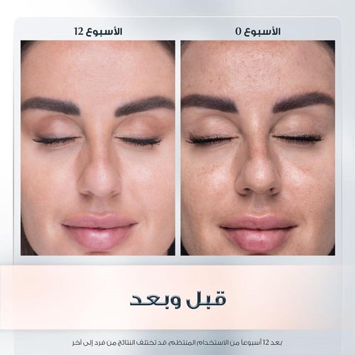 كريم للوجه لمكافحة التجاعيد من يوسرين - 48 غرام