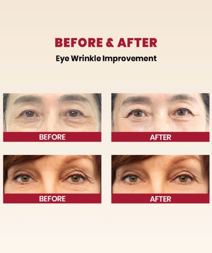 كريم سيول 1988 للعين بالريتينال الليبسومي 4% من كي...