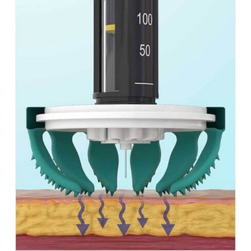 مساعد حقن الأنسولين Tickle FLEX