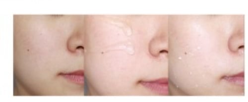 مقشر الجل اللطيف-IUNIK