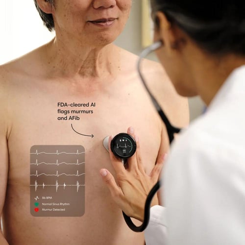 Eko CORE 500™ Digital Stethoscope-Silver
