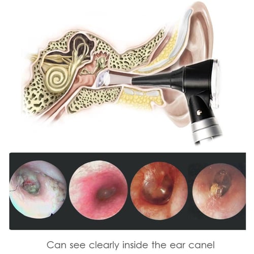 منظار فحص الأذن - اوتوسكوب - otoscope