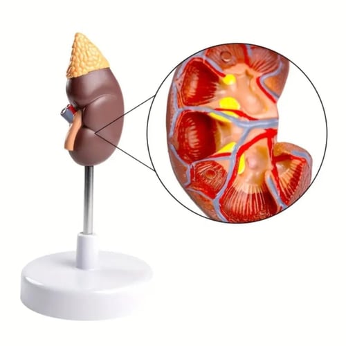 مجسم الكلية والغدة الكظرية