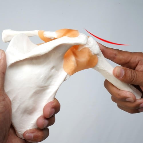 مجسم مفصل الكتف