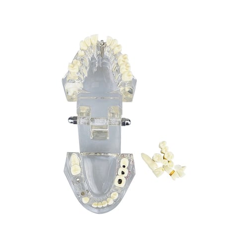 نموذج امراض الأسنان