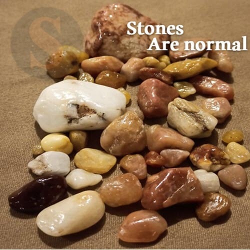 44 حجر طبيعي بمحتلف المقاسات للزينة