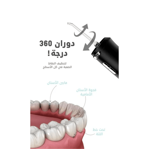 ويكسانا خيط الأسنان المائي – 6 رؤوس / 300 مم Wixsa...