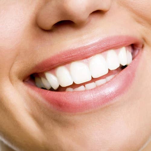 ميريدول معجون أسنان يبيض الأسنان بلطافة 75 مل