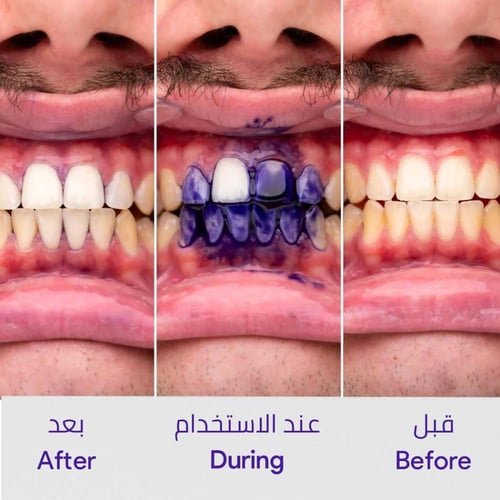 هاي سمايل في34 سيروم مصحح لون الأسنان Hismile V34...