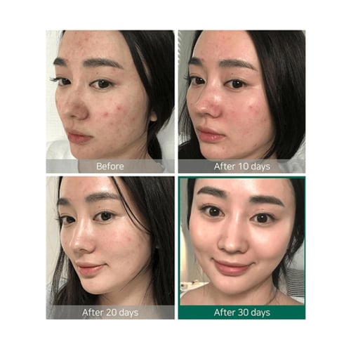 تونر سوم باي مي AHA BHA PHA لتنقية وتقشير البشرة ب...