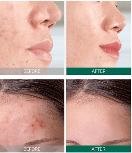 مجموعة سوم باي مي AHA BHA PHA للعناية اليومية وتصف...