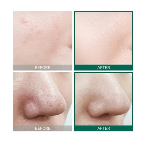 تونر سوم باي مي AHA BHA PHA لتنقية وتقشير البشرة ب...