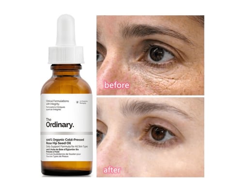 سيروم الكافيين 5% + EGCG من ذا اورديناري للهالات و...