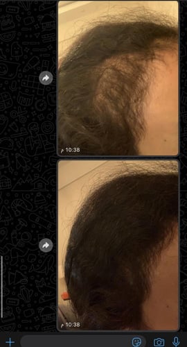 عرض واحد والثاني مجاناً +زيت مشاط هديه ضمان ذهبي