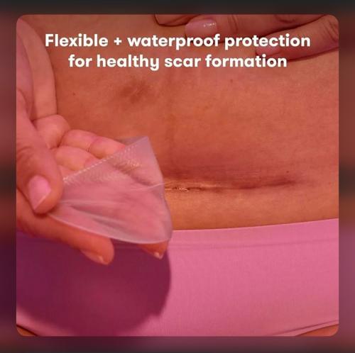 بكج النفاس بالمتكامل عد الولادة القيصرية