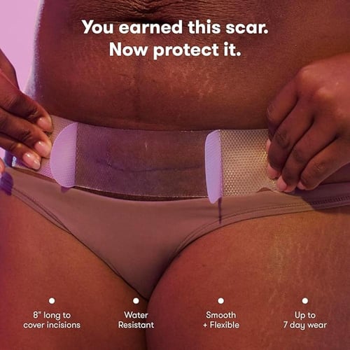 Frida mom- لصقات سيليكون فريدا مام لتخفيف آثار ندب...