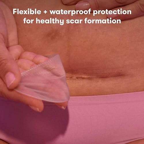 Frida mom- لصقات سيليكون فريدا مام لتخفيف آثار ندب...