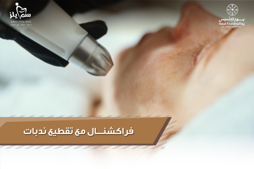 فراكشنال مع تقطيع ندبات