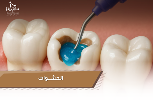 الـــحــشـــــــــوات تــــبــــــــــــدأ مــــــ...