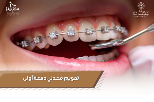 تقويم معدني دفعة أولى