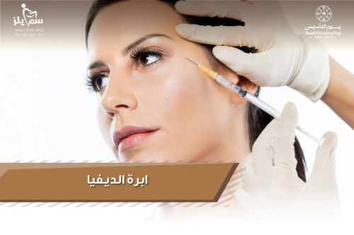 ابرة الديفيا