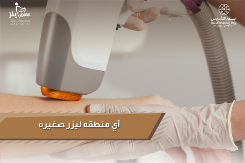 أي منطقة ليزر صغيرة